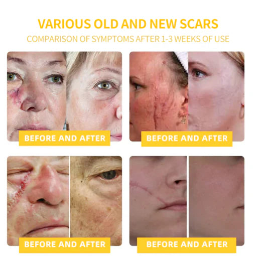 2025 LOVILDS™ Bee Toxin Skin Repair Cream(AAD Recommended👨⚕️)