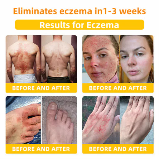 2025 LOVILDS™ Bee Toxin Skin Repair Cream(AAD Recommended👨⚕️)