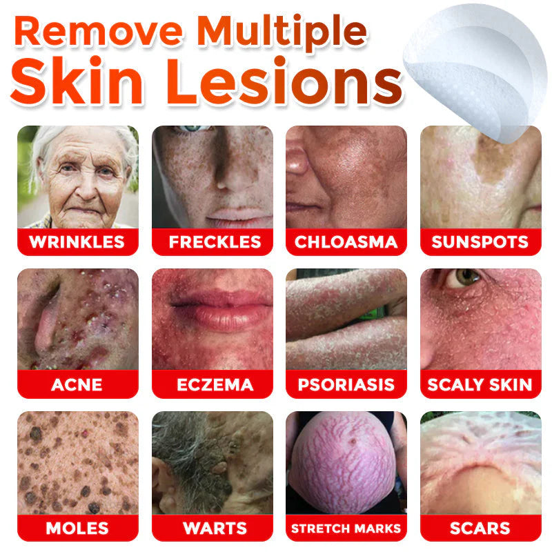 2025 SkinPrikyn™ MicroNeedle Botanic Skin Tag Removal Patch 🇺🇸 Made in the USA