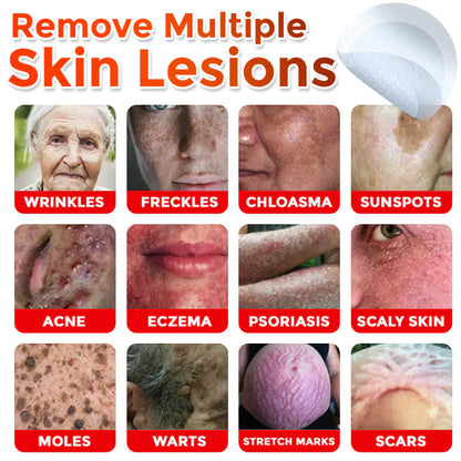 2025 SkinPrikyn™ MicroNeedle Botanic Skin Tag Removal Patch 🇺🇸 Made in the USA