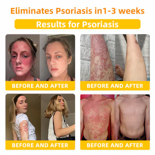 2025 LOVILDS™ Bee Toxin Skin Repair Cream(AAD Recommended👨‍⚕️)