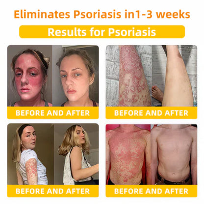 2025 LOVILDS™ Bee Toxin Skin Repair Cream(AAD Recommended👨‍⚕️)