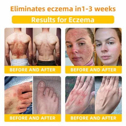 2025 LOVILDS™ Bee Toxin Skin Repair Cream(AAD Recommended👨‍⚕️)